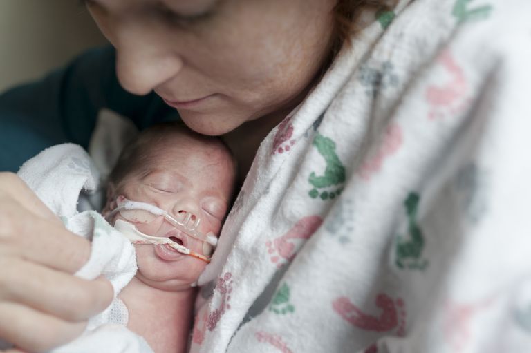 atelektazu novorođenčadi, bebe mogu, dišne ​​putove, dišni putovi, dišnih puteva, mogu dobiti