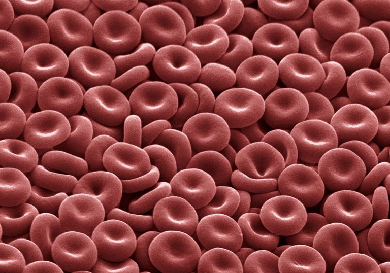 uzrokovati anemiju, koštanoj srži, krvnih stanica, može uzrokovati, crvenih krvnih