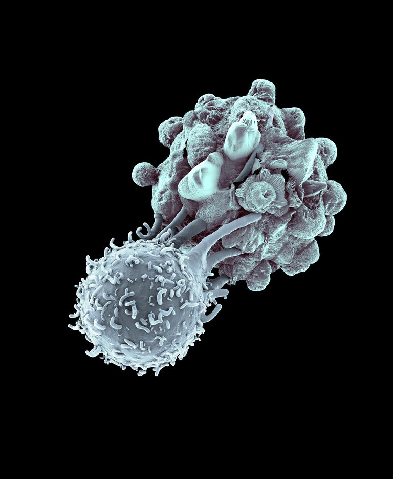 stanice koje, stanice raka, Hodgkinovog limfoma, krvne stanice, American Cancer