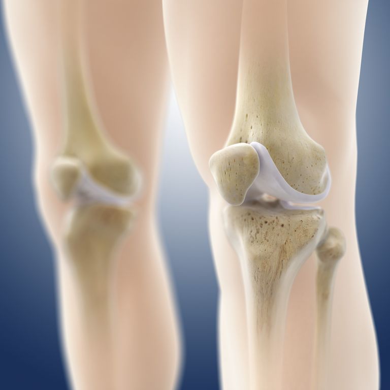prijenosa hrskavice, oštećenja hrskavice, koji imaju, oštećenje hrskavice, oštećeno područje, područja koljena