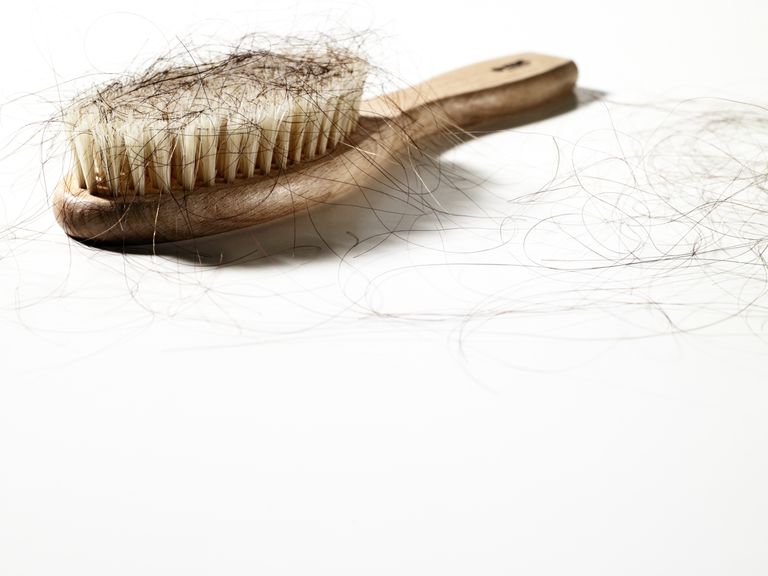 gubitka kose, fibroza Alopecija, gubitak kose, prednjeg fibroza