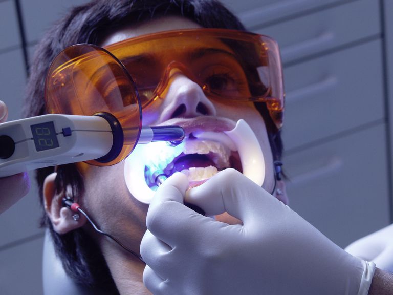 izbjeljivanje zubi, Zubi izbjeljivanje zubi, pasta izbjeljivanje