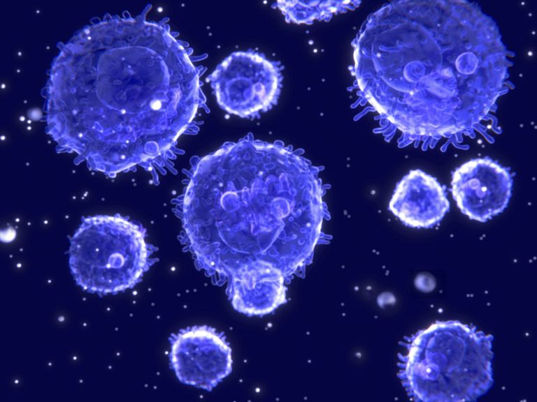 folikularni limfom, koje izgledaju, limfom stanica, limfom T-stanica, može biti