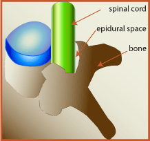 Epiduralni prostor, donjem dijelu, epiduralne injekcije, Epiduralni prostor područje