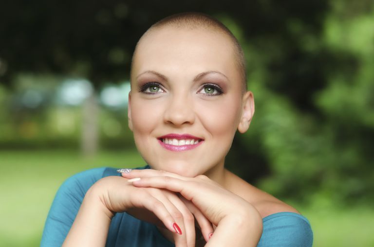 gubitak kose, može biti, gubitka kose, liječenja raka