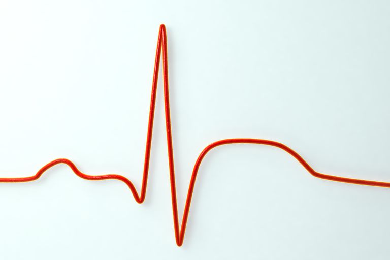srčanog udara, srčani udar, smrti može, srčani zastoj, srčanog mišića