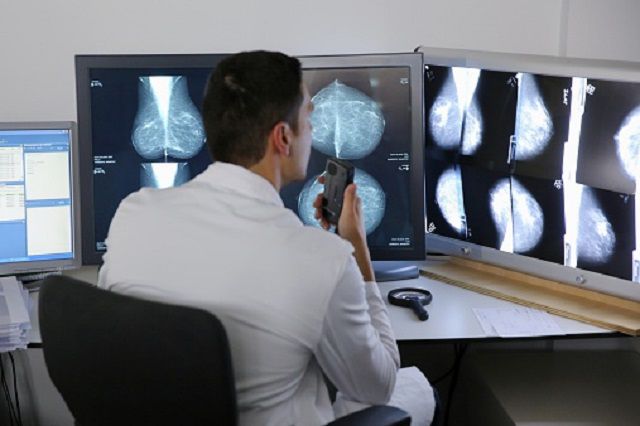 raka dojke, Digitalni mamografija, korišteni sljedeći, korišteni sljedeći različiti, prije nego, raka maternice