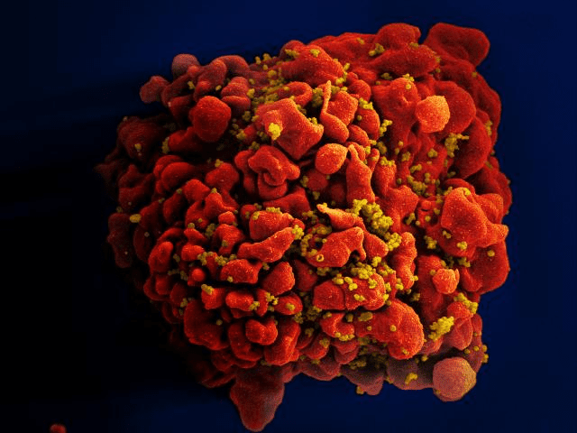 imunološki sustav, milijuna ljudi, bolesti povezanih, bolesti povezanih HIV-om, gdje imunološki
