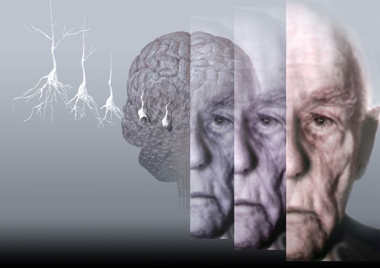 Alzheimerova bolest, Kako osoba, A-B-C ponašanja, Alzheimerova bolest utječe, Alzheimerovom bolešću, bolest utječe