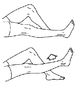 artroskopije koljena, kako biste, nakon artroskopije, opustite Ponovite