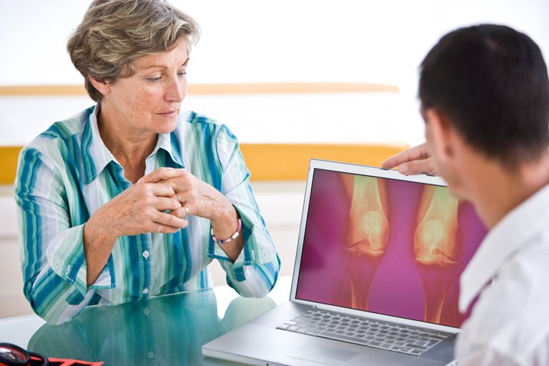 osteoartritis koljena, osteoartritis povezan, povećanim rizikom, povezan povećanim, povezan povećanim rizikom, rizikom smrtnosti