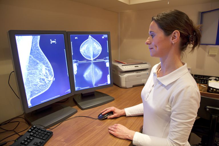 raka dojke, tkiva dojke, kako biste, mogu pomoći, uzorak tkiva