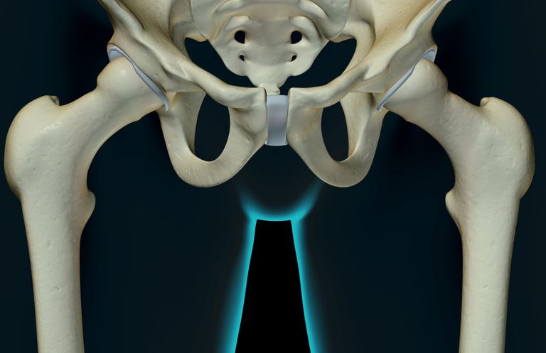 karpalnog tunela, tijekom trudnoće, često može, dijelu leđa, dodatne težine