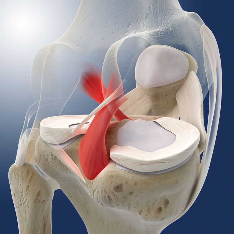 ligamenta koljena, mogu biti, nakon ozljede, ozljede PCL-a, rekonstrukcija PCL-a, biti povezane