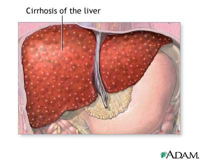 enzime jetre, masne jetre, više informacija