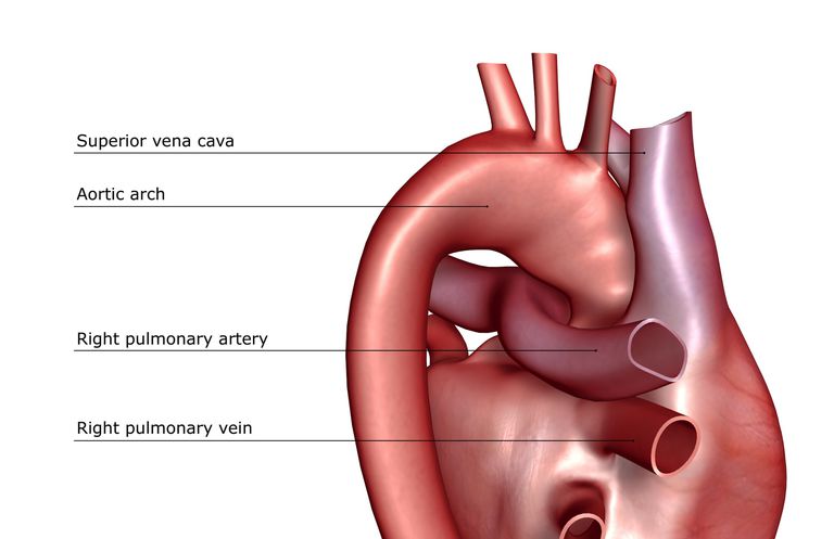 arterijska hipertenzija, našeg srca, plućna arterija, plućna hipertenzija, Pulmonarna arterija, arterija koje