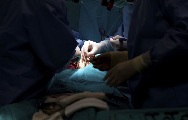 nakon operacije, kirurški zahvat, koronarna arterija, zaobići kirurgija