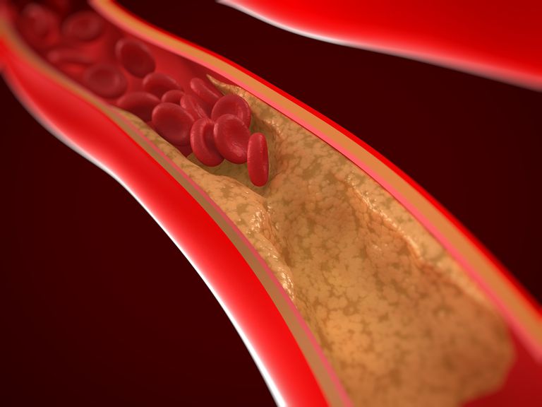 koronarne arterije, arterije koje, četiri arterije, glatke mišiće, koje mogu, koronarna arterija