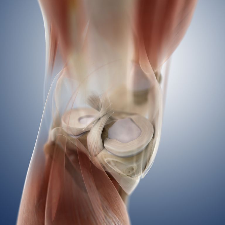 zamjena koljena, bolove koljenu, kirurgija koljena, koljena može, ostatak tkiva