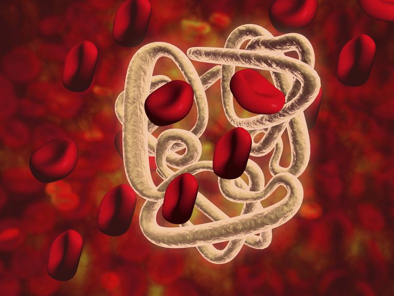 crvenih krvnih, krvnih stanica, alfa talasemije, crvenih krvnih stanica, beta lanca, krvne stanice