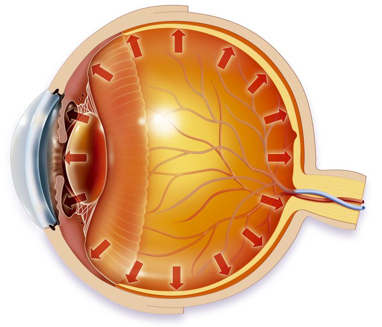 nakon operacije, kako biste, kapi kako, laserska kirurgija, pritisak očiju, tlak očima