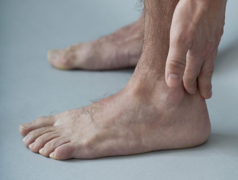 nogu gležnja, tibijski tendonitis, nožni prst, stražnji tibijski, stražnji tibijski tendonitis, Ahilni tendonitis