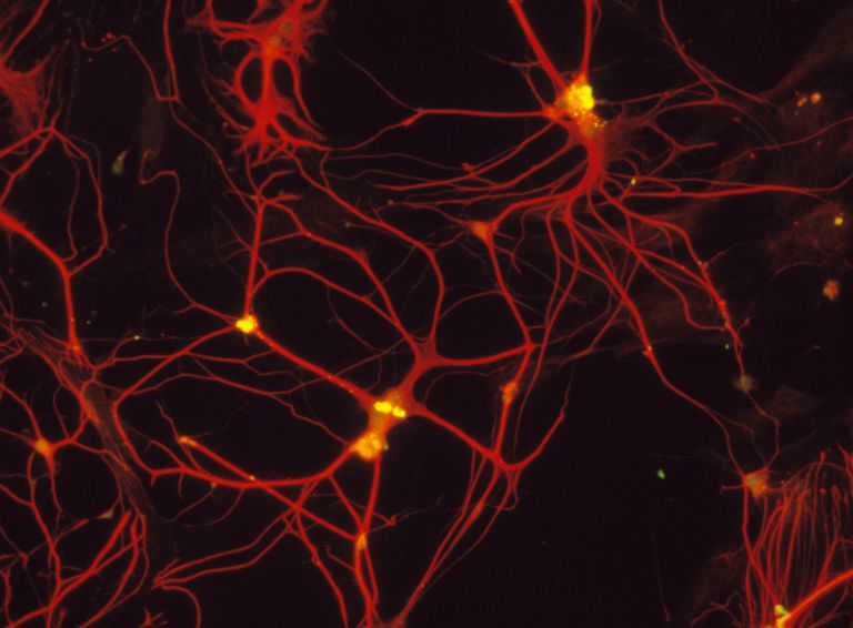 Schwannove stanice, vašeg mozga, živčanom sustavu, Ependimske stanice, glialne stanice, glijalne stanice