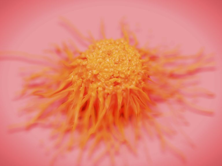 Sertoli-Leydig tumori, Sertoli-Leydig tumori stanica, tumori stanica, muških hormona, nakon liječenja, tumora jajnika