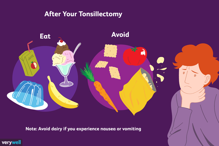 nakon operacije, nakon tonzilektomije, jesti nakon, jesti nakon tonzilektomije, biste smanjili