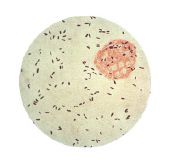 stanice kože, čimbenika koji, stratum corneuma, bakterije koje, mrtve stanice, mrtve stanice kože