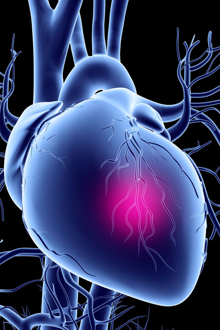 bolesti srca, Framingham Heart, Framingham Heart Study, Heart Study