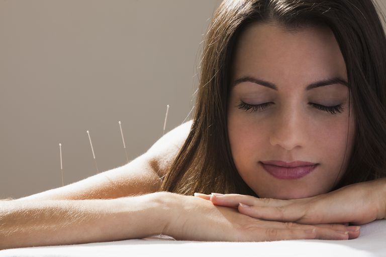 akupunkturne tretmane, komplementarna terapija, može biti, može pomoći, pokazala akupunktura