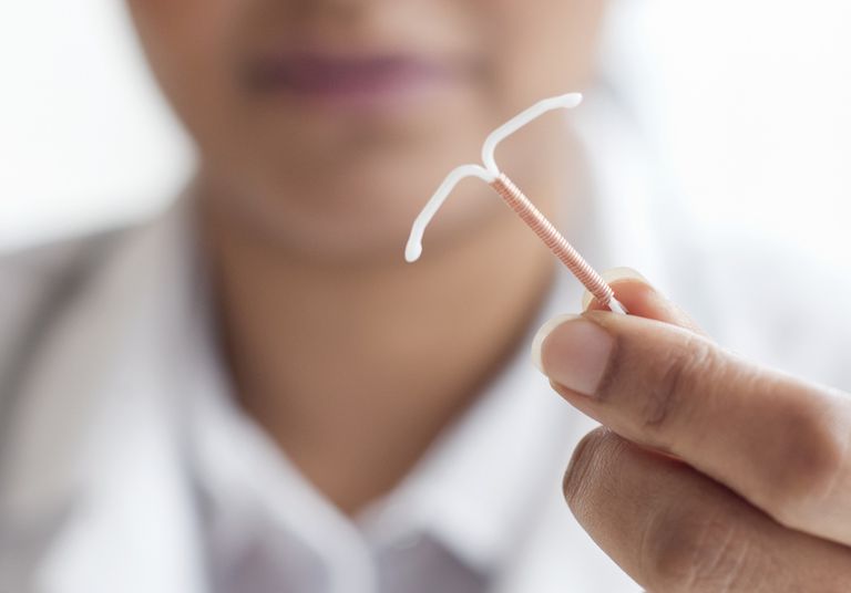 uklanjanje IUD-a, može biti, uklanjanja IUD-a, vaše žice, liječnik može, nakon imali