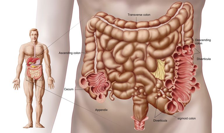 debelo crijevo, abnormalnog tkiva, prije testa, sigmoidni debelo, sigmoidni debelo crijevo