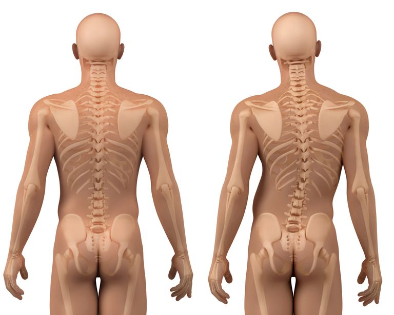 bolova leđima, djece adolescenata, leđima djece, mogu biti, mišićna leđima, mogu uzrokovati