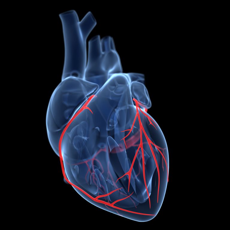 srčani mišić, koronarne arterije, Anatomija koronarnih, Anatomija koronarnih arterija, arterija prikazana, blokira srčani