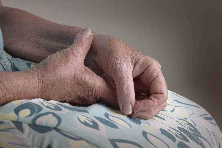 Reumatoidni artritis, može postati, nastaje kada, Proksimalna redna