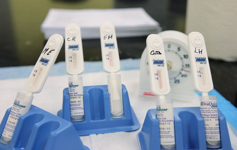 testiranja HIV-a, testova koji, biste trebali, koji koriste